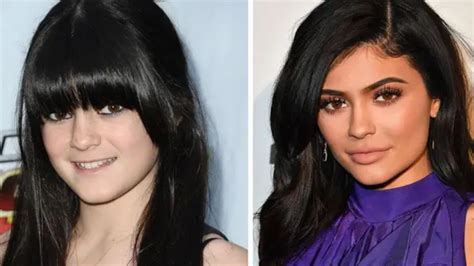 kylie jenner age|kylie jenner before and after.